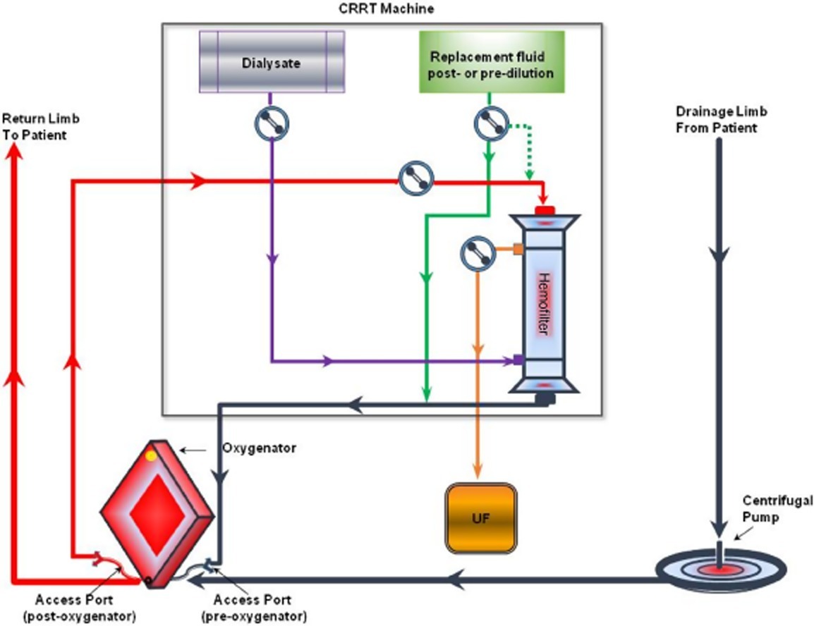 ECMO RRT HLS circuit diagram